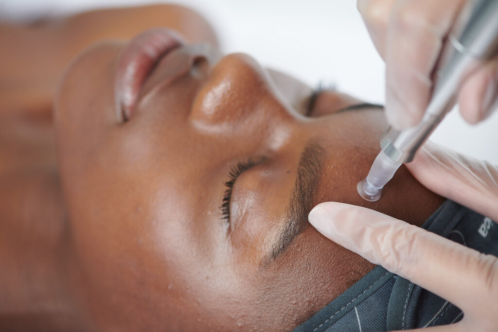 Dermalogica-Pro-Microneedling-Discount-Canterbury-Beauty-Salon