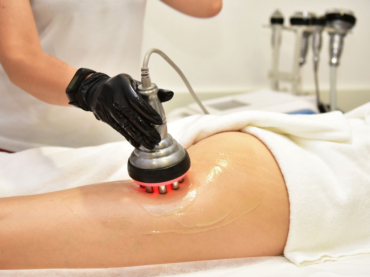 lipocavitation-en-quoi-consiste-cette-technique-amincissante